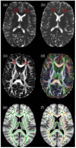brainsci-04-00405-g001